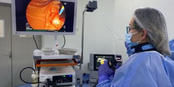 PRIMERA COLANGIOPANCREATOGRAFÍA RETRÓGRADA ENDOSCÓPICA (CPRE) EN CLÍNICA ANDES SALUD CHILLÁN.