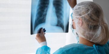 Profesionales de salud refuerzan llamado a prevenir y diagnosticar oportunamente el Cáncer de Pulmón.