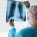 Profesionales de salud refuerzan llamado a prevenir y diagnosticar oportunamente el Cáncer de Pulmón.