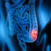 Mes del Cáncer de Colon: Alianza entre Clínica Universidad de los Andes y la Universidad de Kyoto para el avance en el tratamiento del cáncer de colon.