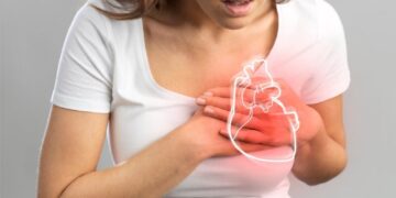 Infarto agudo al miocardio y ataque cerebrovascular: principales causas de muerte en mujeres