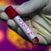LA SUPER GRIPE馃敼锔廙insal confirma detecci贸n de subclado K de influenza A(H3N2) en Chile.