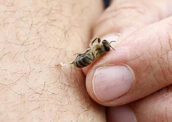 Picaduras de abeja: una reacción que puede transformarse en una urgencia vital.