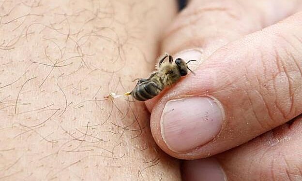 Picaduras de abeja: una reacción que puede transformarse en una urgencia vital.