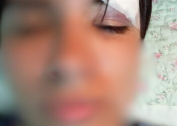 Madre denuncia agresión a su hijo en un liceo de la región de Ñuble. (Lea versiones de ambas familias y del liceo)