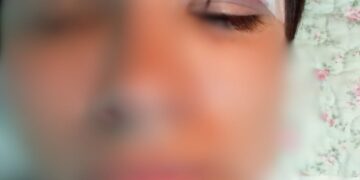 Madre denuncia agresión a su hijo en un liceo de la región de Ñuble. (Lea versiones de ambas familias y del liceo)