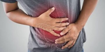 Cáncer de Colon aumentó entre jóvenes: El 90% de los casos puede curarse si se detecta a tiempo.